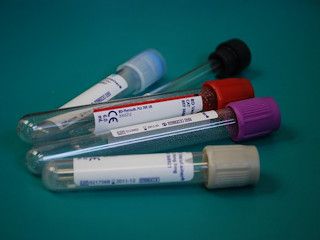 Co wpływa na wyniki badań krwi?