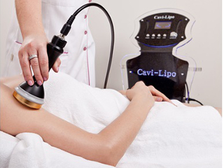 Cavi – Lipo – piękna figura, likwidacja cellulitu